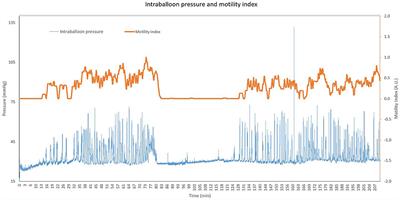 Repeated Gastric Motility Measurement Affects Gastric Motility and Epigastric Symptom Sensation